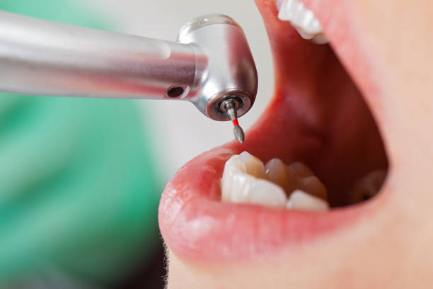 Best Pediatric Emergency Dentist in Biloxi, MS